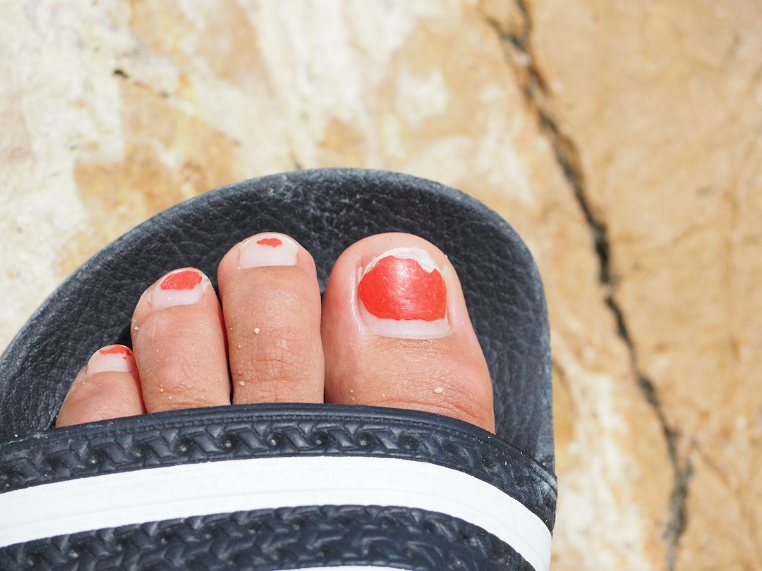 Signs of Toenail Fungus: Early Symptoms to Watch For